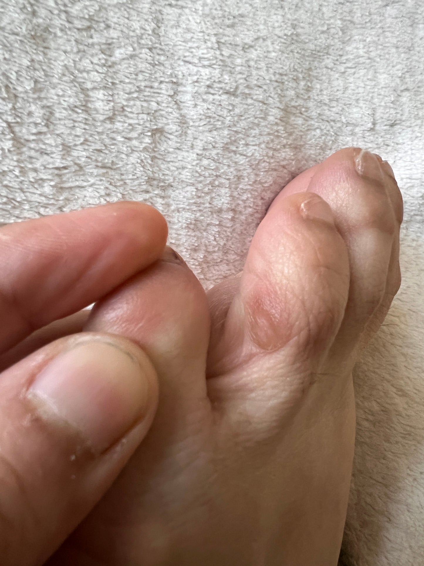 SILICONE ANTI-FRICTION TOE PROTECTOR