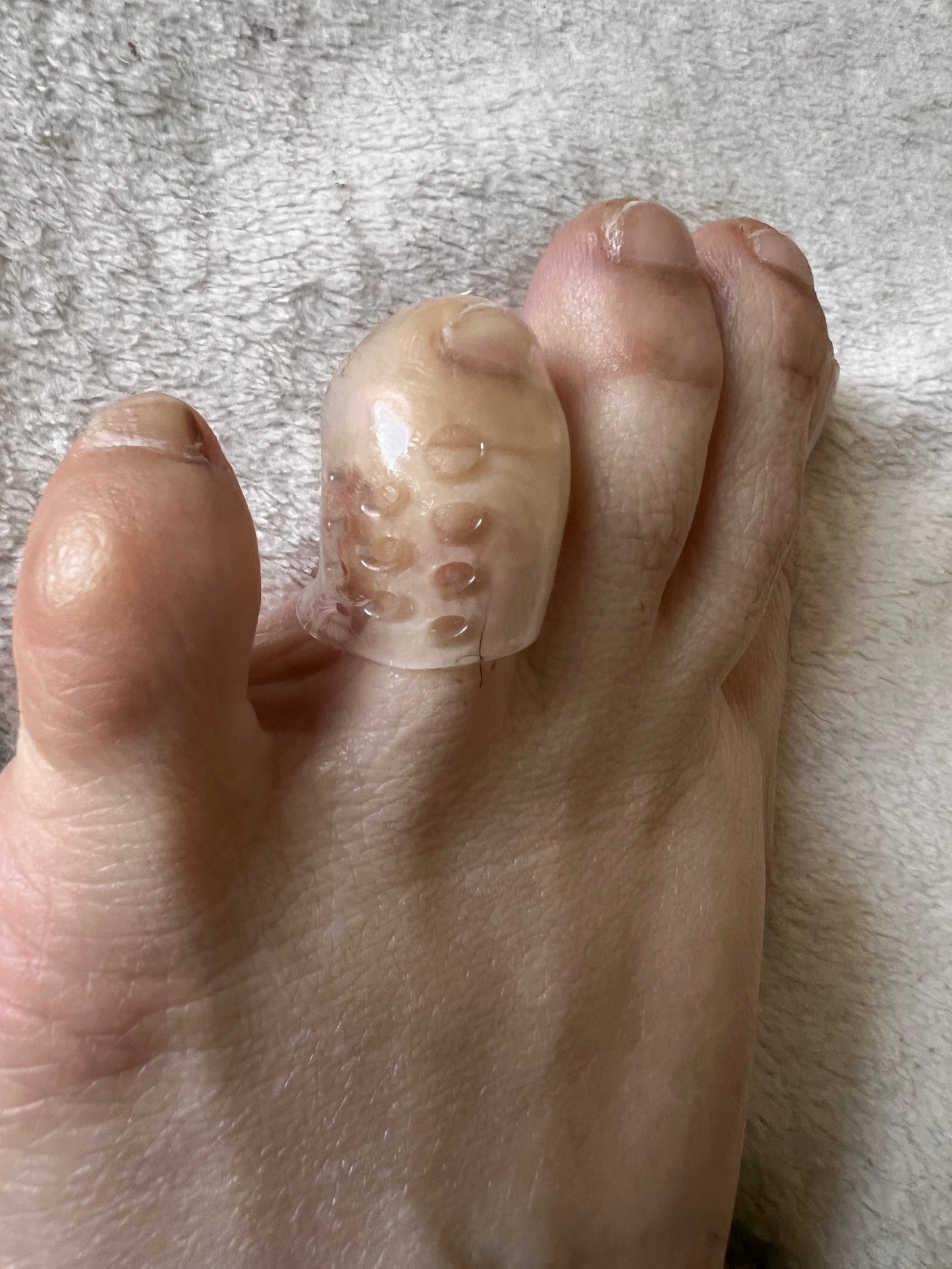 SILICONE ANTI-FRICTION TOE PROTECTOR