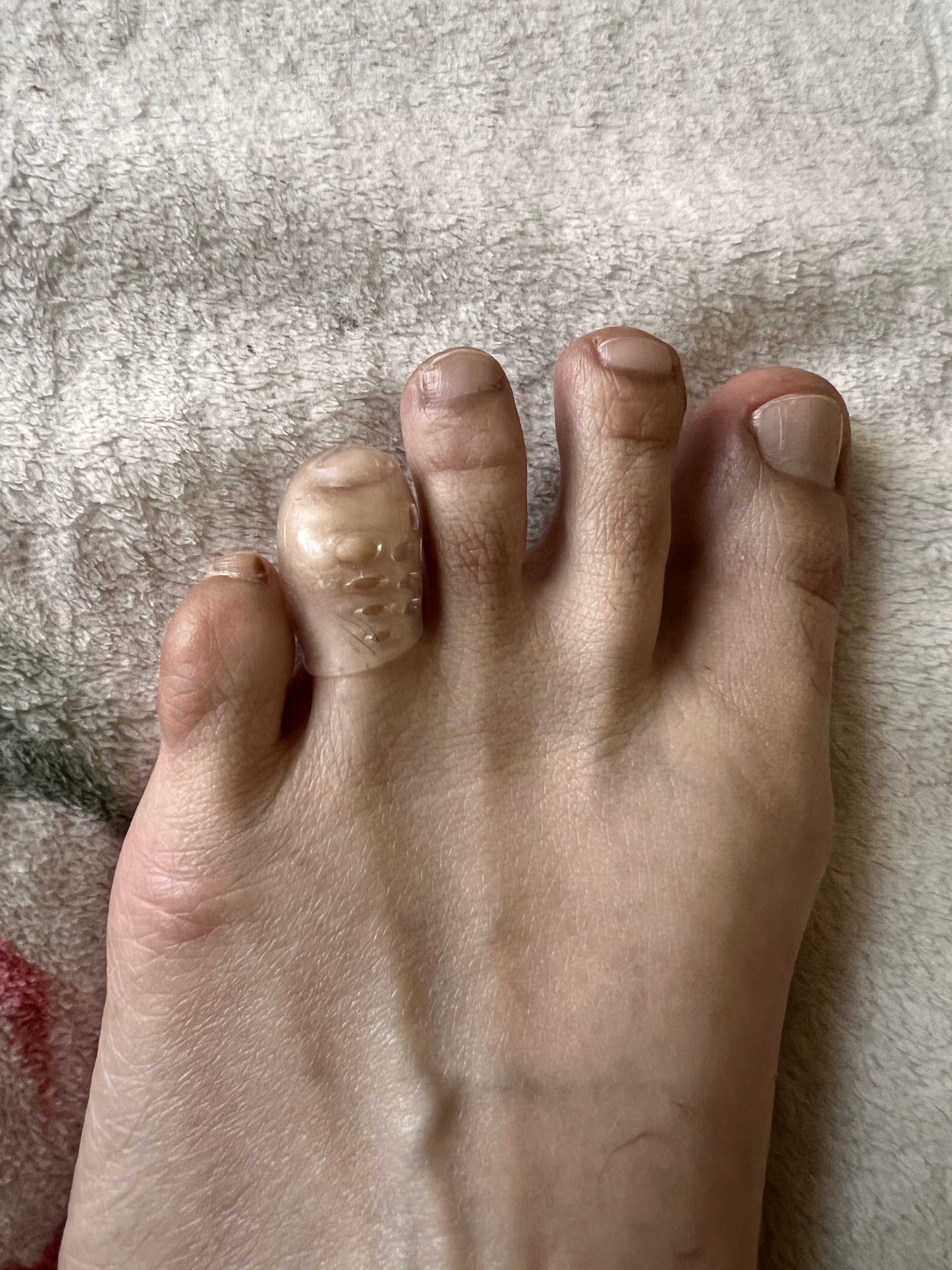 SILICONE ANTI-FRICTION TOE PROTECTOR